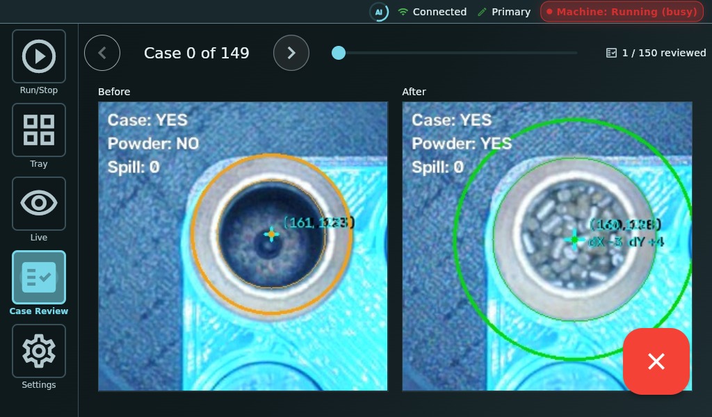 LoadBot case review screen